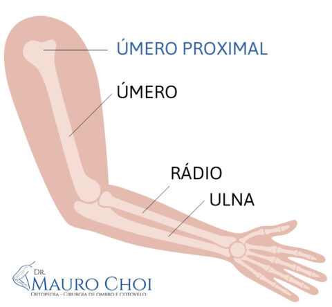 Fratura Do Mero Proximal Tudo O Que Voc Precisa Saber Sobre Esse Tipo De Les O Dr Mauro Choi