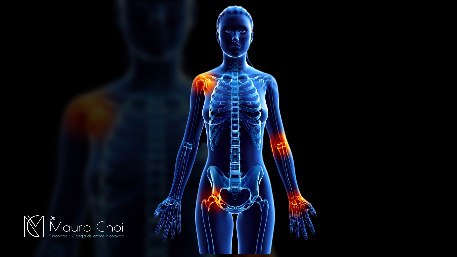 Anatomia do ombro: saiba tudo sobre essa articulação - Blog Fisioterapia
